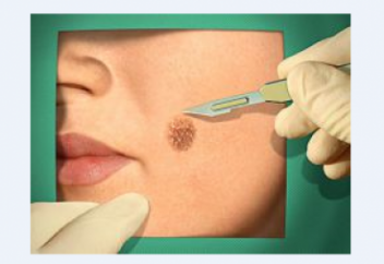 Меңнің қандай зияны бар