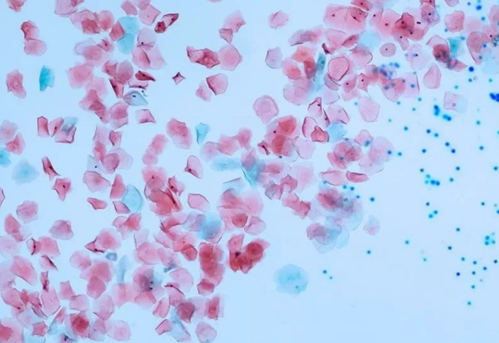 Қанды микропластиктен тазартудың жолы табылды