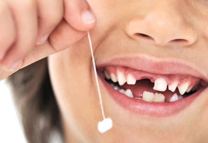 Дронның көмегімен тісін жұлды (видео)