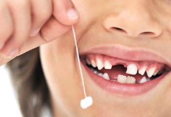 Дронның көмегімен тісін жұлды (видео)