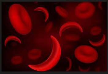 Науқасты тұңғыш рет анемиядан CRISPR көмегімен емдеді