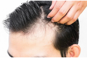 Шаштың түсуін тоқтататын әдіс табылды