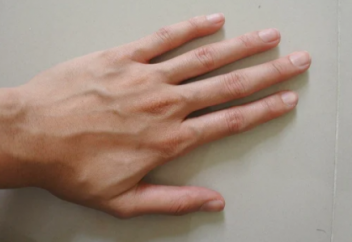 Почему вены синие, если кровь красная?