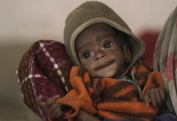 Әлемде 1 минутта аштан өлетіндер қарасы короновирустан 1 минутта көз жұматындардан көп