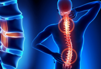 Бехтерев ауруы қалай пайда болады – дәрігер кеңесі