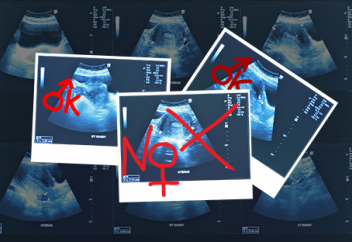 Құрсақтағы баланың жынысын анықтау арқылы түсік жасатуға тыйым салуды ұсынды