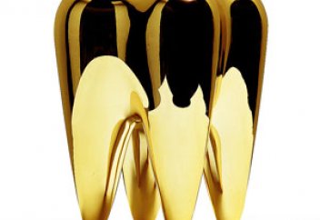 Ел жаңалықтары: Алтын тістер шекарадан өткен кезде қиындықтар туғызуы мүмкін