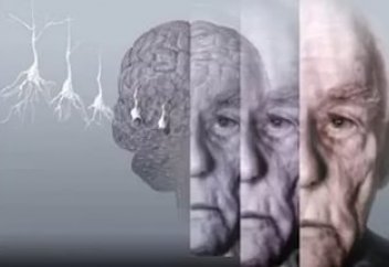 Названы главные способы избежать слабоумия