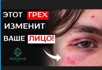 ЭТИ ГРЕХИ ПРЯМО ВЛИЯЮТ НА ВАШЕ ЛИЦО! | Mutaalib Media