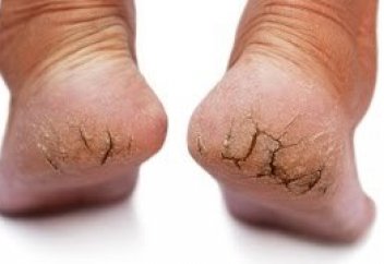 Теріні қалпына келтірудің жаңа тәсілі пайда болды