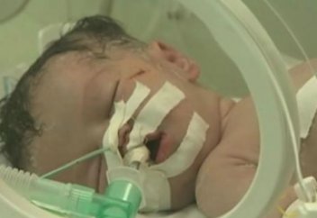 Дәрігерлер израилдіктер оғынан қаза тапқан әйелдің құрсағынан шарананы аман алып қалды