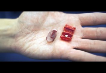 Асқазандағы бөтен затты алып шығатын шағын робот жасалды (ВИДЕО)