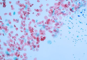 Ғалымдар пластикалық шөлмектегі судың денсаулыққа қаншалықты қауіпті екенін анықтады