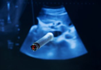 Курение вредит эмбрионам на клеточном уровне