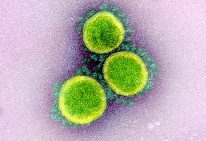 Хуаньцю шибао (Китай): в разных регионах распространены разные типы коронавируса? Появится ли в конечном итоге «супертип»? Какое влияние окажет мутация COVID-19