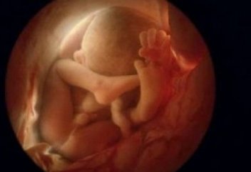 Жатыр жайлы мысал