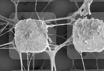 Тірі нейрондар компьютер микрочипіне енгізіледі