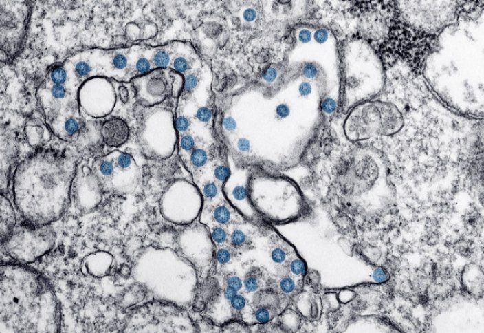 Ученые предупредили о новой опасной способности коронавируса