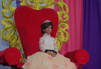 150 жастағы әже секілді қартайып кеткен 19 жастағы қыз көз жұмды (фото)