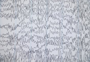 Жасушаның биологиялық электр алаңын өзгертетін құрылғы жасалды. Обыр мен өзге ауруларды емдеуге көмектесетін