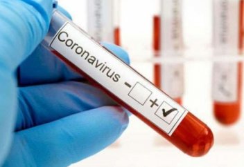 Коронавирустың симптомсыз түрін жұқтырған науқастарға нұсқаулық? Коронавирус анықталып, симптомы жоқ болса не істеу керек?