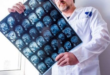 Жас кезінде артық салмақтан зардап шеккендердің қартайғанда жадысы нашарлайды