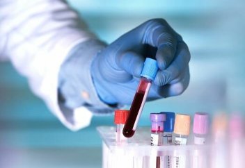 Адамның ғұмыр жасын анықтайтын қан анализі пайда болды