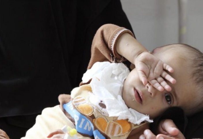 Разное: В Йемене ежедневно умирает 12 рожениц