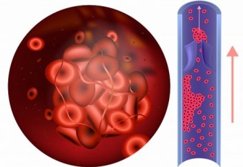 Доктор рассказала об опасности еще одного лекарства при коронавирусе. Врач показала последствия домашнего лечения дексаметазоном