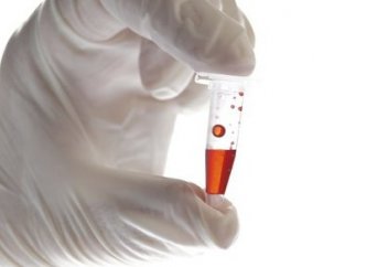 Ученые описали, что COVID-19 делает с организмом человека