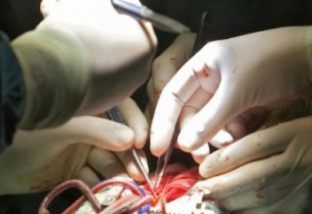 Шымкентте жүрекке жаңа әдіспен ота жасалды