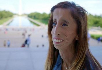 "Әлемдегі ең ұсқынсыз әйел" өз өмірі жайлы деректі фильм түсірді (видео)