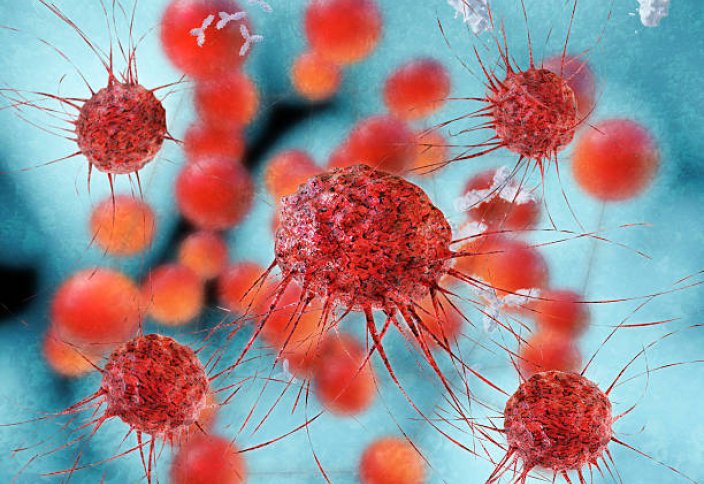 Әлемде жылына 20 млн адам қатерлі ісікке шалдығады