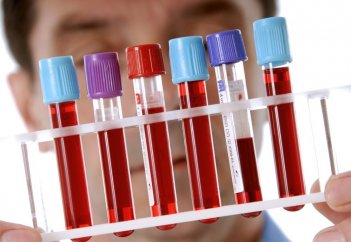 Қазақстандық дәрігерлер енді ауруды алдын ала анықтай алады