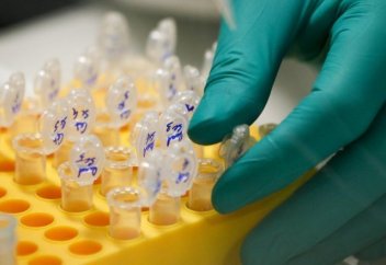 Об угрозе новой «Х-инфекции» сообщил главный санврач РК