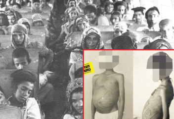 Израилдік дәрігерлердің араб балаларына жасаған тәжірибесі әшкере болды