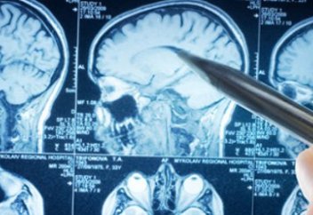 На востоке Индии почти 130 детей погибли из-за вспышки острого энцефалита