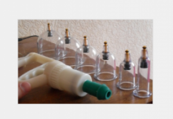 Сары ауру, АИТВ: Дәрігерлер хиджама арқылы түрлі ауру жұқтырып алуға болатынын ескертті