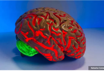 Қан қысымы мен сусамыр ми құрылымын өзгертеді