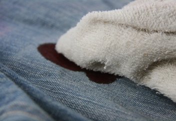 Жуылған киімде қанның дағы кетпесе, сол киіммен намаз оқуға бола ма?