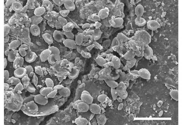 Микропластиктен аса қауіпті бактерия табылып жатыр
