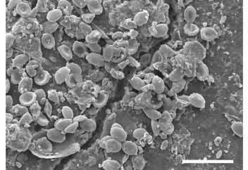 Микропластиктен аса қауіпті бактерия табылып жатыр