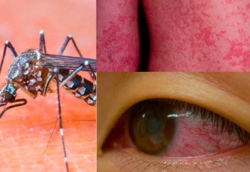 Лихорадка Зика… распространение эпидемии