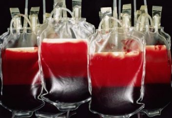 Ультрадыбыс донорлық қанның сақталу мерзімін ұзартады