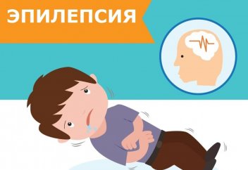 Ғалымдар эпилепсияның пайда болуына не себепші болатынын анықтады