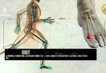 Алкоголь - самый большой убийца в мире