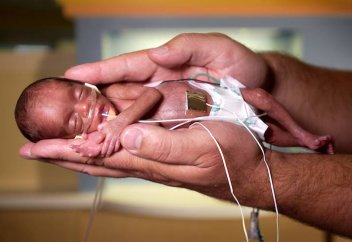 Шала  туған шақалақ туралы аз-кем дерек