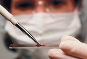 Британские медики впервые вылечили от ВИЧ взрослого человека