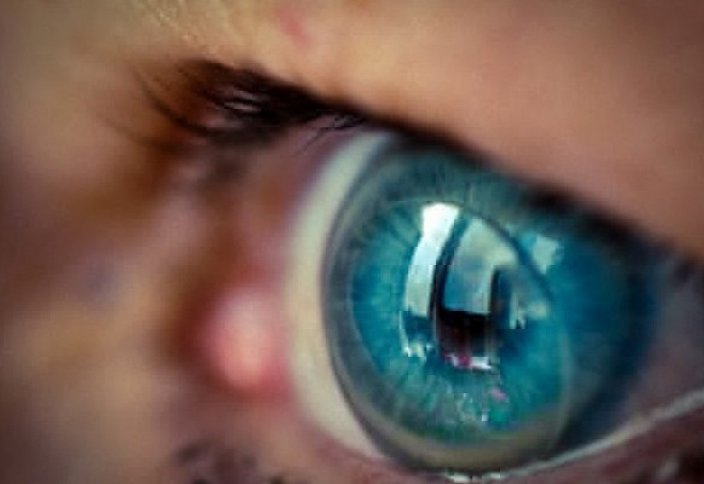 Врачи: контактные линзы могут привести к потере зрения