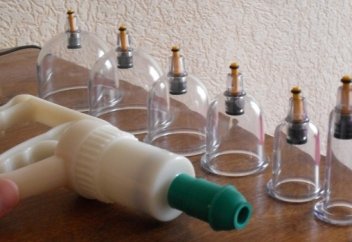 Қан алып емдеуге (хижама) қатысты ҚР Денсаулық сақтау министрі қандай пікір білдірді? Ақтөбе облысының бас дәрігері хижамаға неге қарсы?